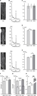 Cholesterol Protects Against Acute Stress-Induced T-Tubule Remodeling in Mouse Ventricular Myocytes